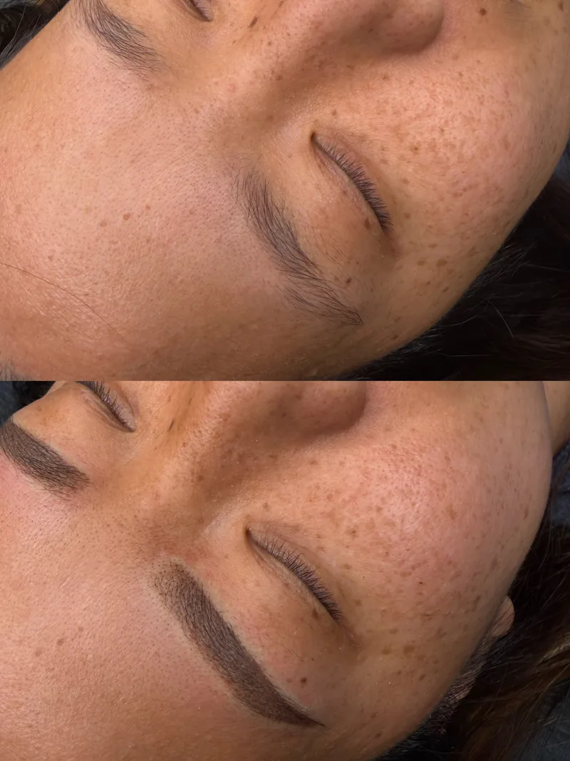 Before and after microblading